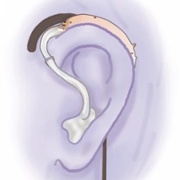 Picture of inductive earhooks for T or Loop programme2.jpg