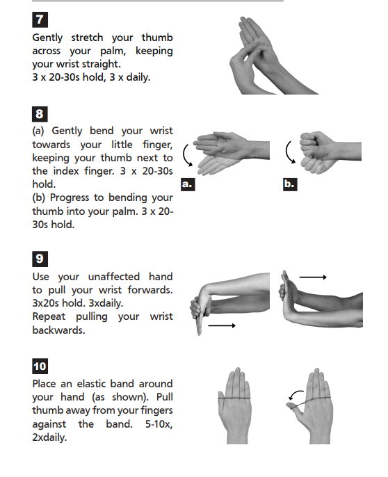 De Quervains Tenosynovitis Swansea Bay University Health Board De Quervains Tenosynovitis Swansea Bay University Health Board