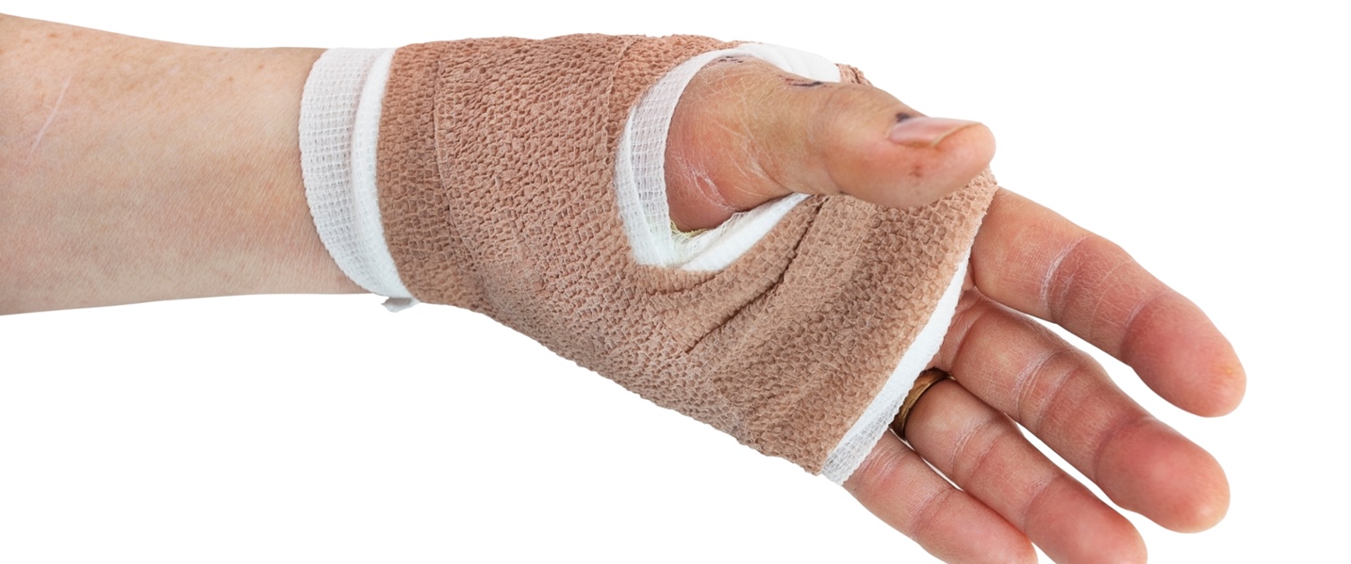 A picture of a bandaged hand