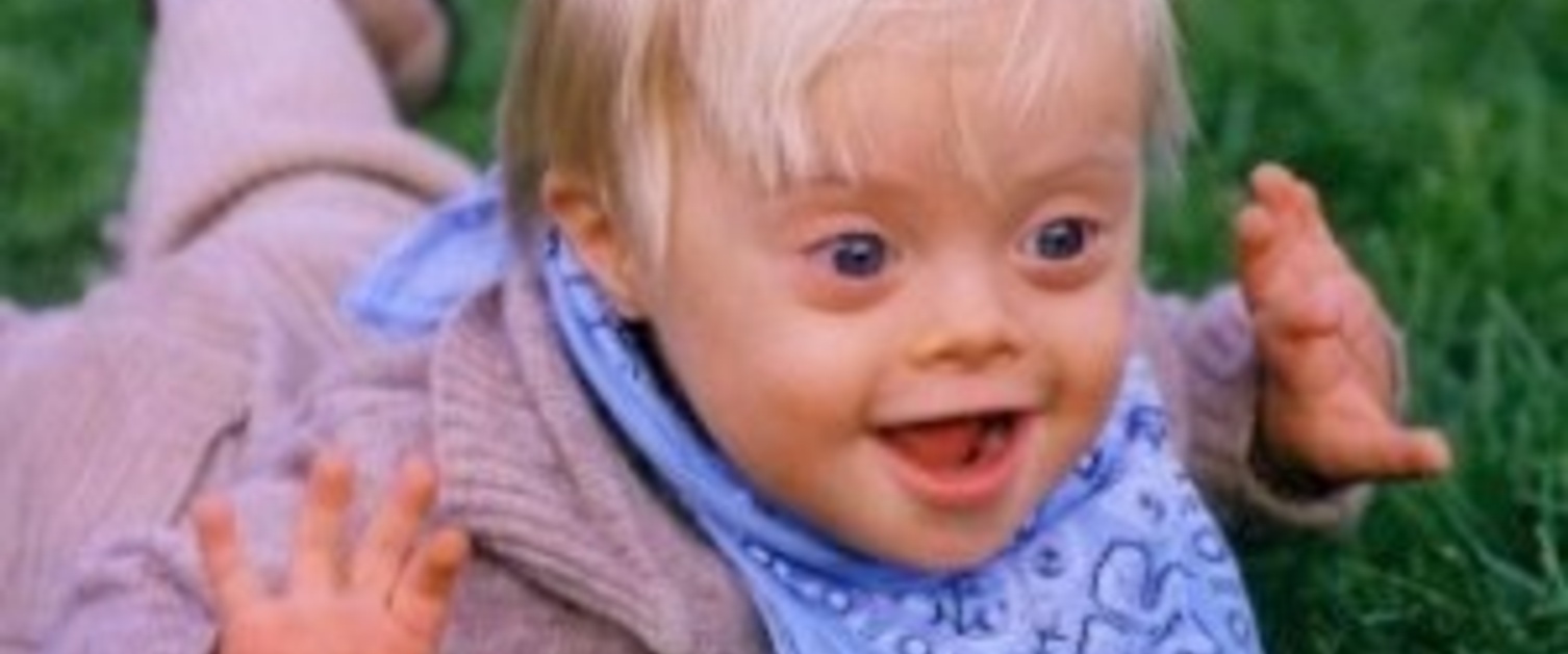 A young boy with Down