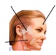 Image shows face from the side with arrows showing injection sites.