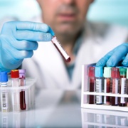 colour top blood test tubes