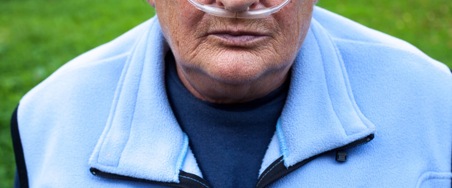Image shows a patient wearing an oxygen tube in their nose.
