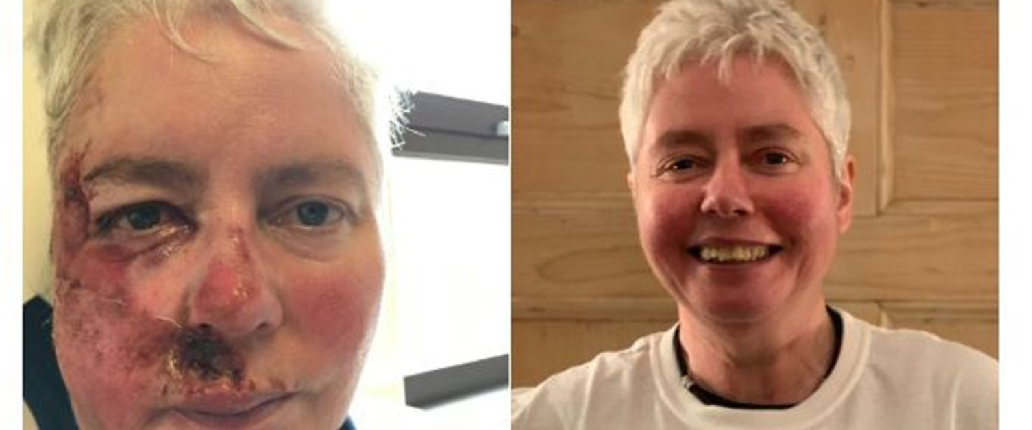 Tweet showing before and after pictures of Rosemary Collins