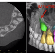 cone beam photo4.png