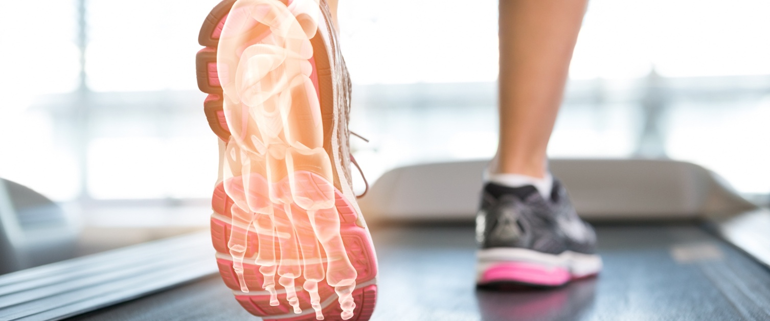 An image of legs on a treadmill. 