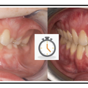 before and after ortho photo8.png