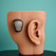 Image shows a bone conduction implant.