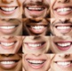 Image is a collage of lots of individual mouths smiling and showing their teeth.