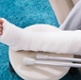 A picture of a broken leg in a cast