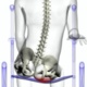 Image of an animated body showing pressure loading due to pelvic obliquity