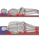 Image shows graphic of patient lying on back and lying on side.