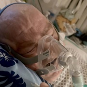 Leighton Davies oxygen mask