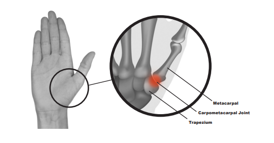 5 Common Causes of Arm and Hand Pain You Should Be Aware of: CHOICE Pain &  Rehabilitation Center: Physical Medicine, Rehabilitation, and Pain  Management