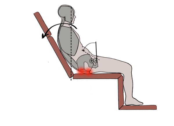 Image shows graphic of patient in a reclined chair. Red spots highlight pressure.