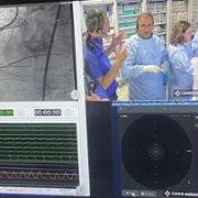 Angioplasty screen Mura.jpg