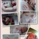 A collage of photos of a neonatal patient