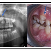 before and after photo3.png