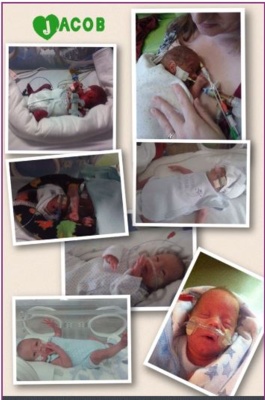 Collage ffotograff yn dangos delweddau babi Jacob