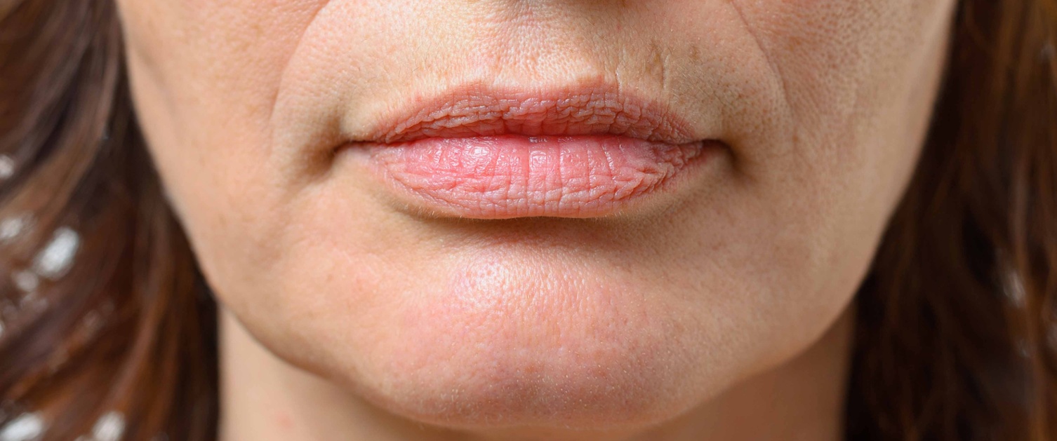 Llun yn dangos cau ceg gaeedig menyw.