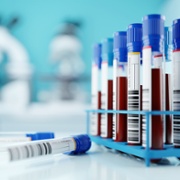A stock image of  a few filled blood test tubes in a crate.