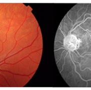 Clinical Photography - Ophthalmology.jpg