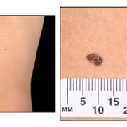 Clinical Photography - Teledermatology.jpg