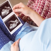Pregnant - scan  photos.jpg