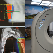 Radiotherapy_scan.png