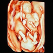 baby_George_Henry_4D.png