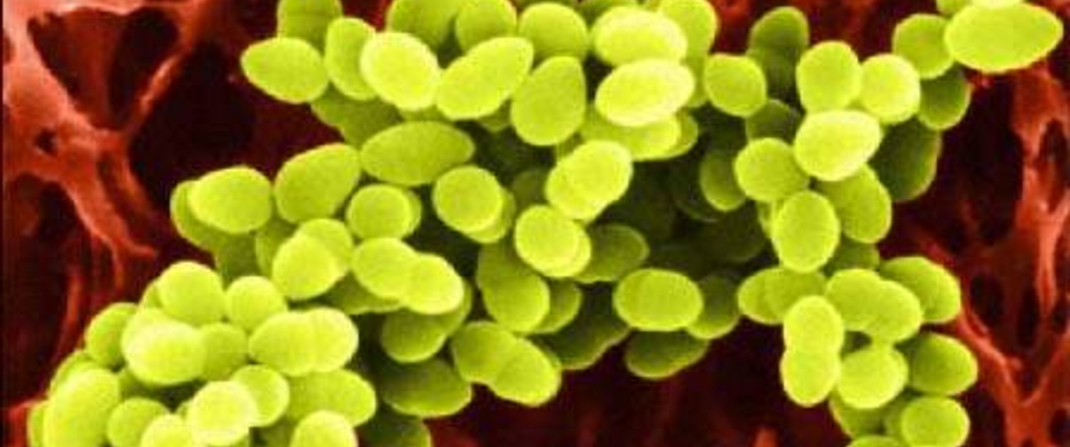 Image of staphylococcus