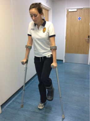 Example of how to walk bearing no weight on the injured leg