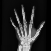 Canva - Hand X-ray Result.jpg