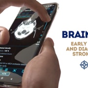 Brainomix