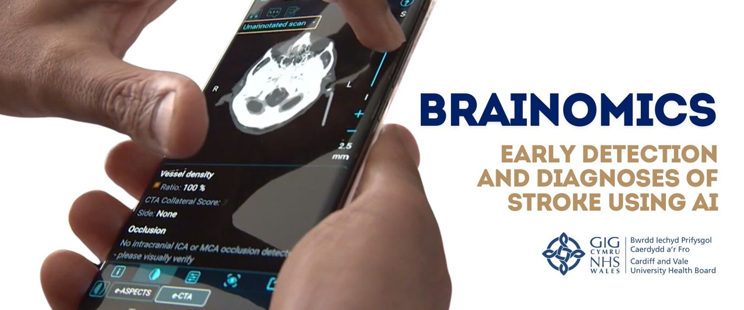 Brainomix - Early detection and diagnoses of stroke using AI | Cardiff and Vale University Health Board