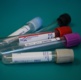 Image of Vacutainers