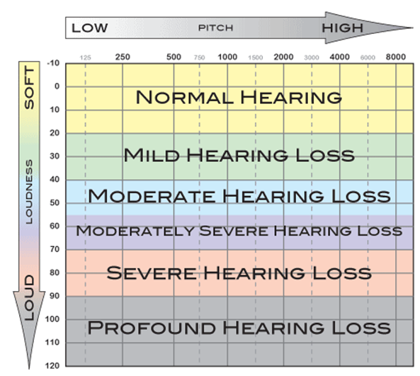 Chart showing levels of hearing loss - Normal hearing	≤25 dB; Mild hearing loss 26-40 dB; Moderate hearing loss	41-60 dB; Severe hearing loss 61-80 dB;  Profound hearing loss	≥81 dB