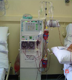 Picture of a dialysis machine