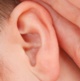 Image of an ear