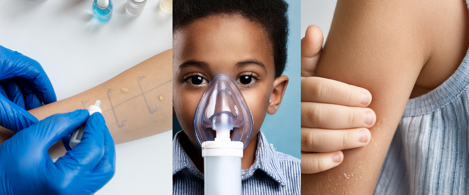 allergy test, child with oxygen mask and child with eczema