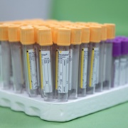 vials of blood for testing