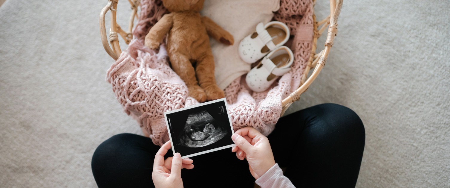 baby scan and basket