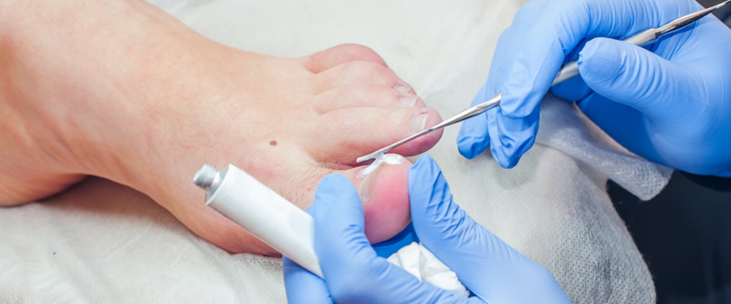 blue nail color during surgery