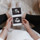 image of person sat with pregnancy scan