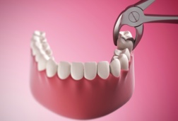 Representation of lower dental arch