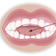 oval teeth from dummy