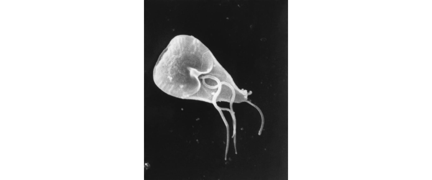 Giardia Cases In The Colwyn Bay Area Public Health Wales