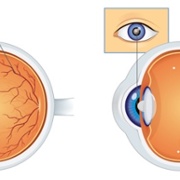 DESW retinopathy diagram