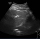 Ultrasound scanning image