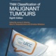 TNM Classification of Malignant Tumours, Eighth Edition.